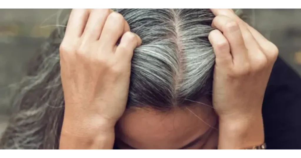 Understanding the Causes of White Hair